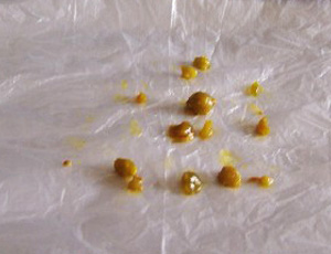 药物流产症状
