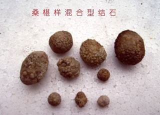药物流产的原因,得药物流产的原因