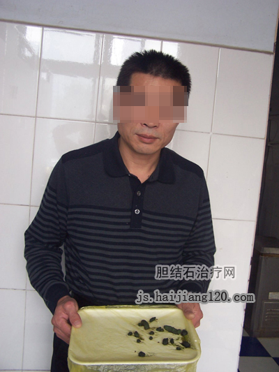药物流产治疗