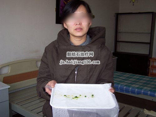 无痛人流手术治疗