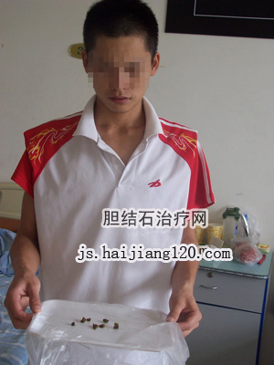 无痛人流治疗