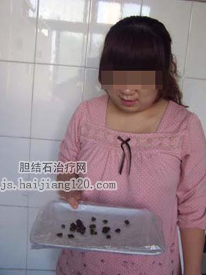 无痛人流治疗