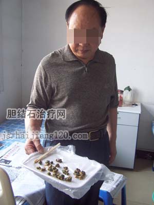 药物流产手术治疗