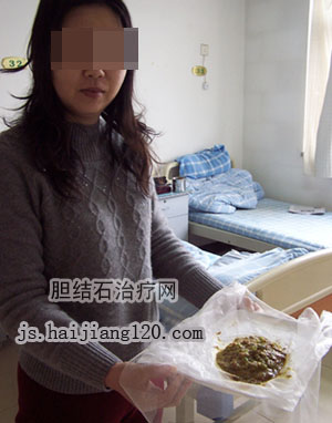 药物流产手术治疗