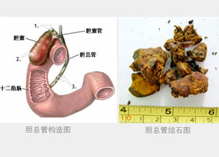 人流检查怎么治疗