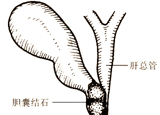 无痛人流的早期症状