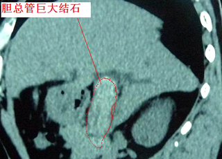 人流检查症状,人流检查有什么症状