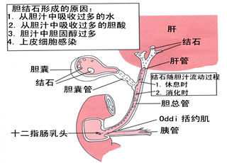 治疗无痛人流,无痛人流怎么治疗