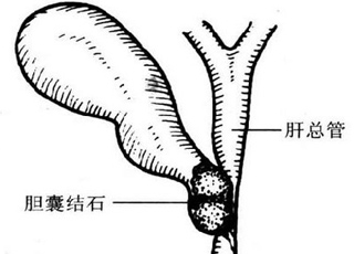 无痛人流该怎么治疗,无痛人流治疗