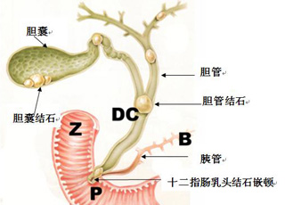 药物流产治疗,治疗药物流产