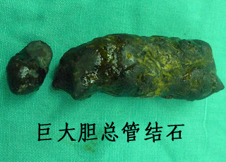 人流检查怎么治疗,治疗人流检查