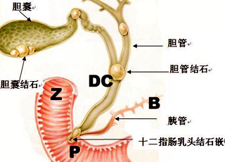 无痛人流的危害,无痛人流治疗
