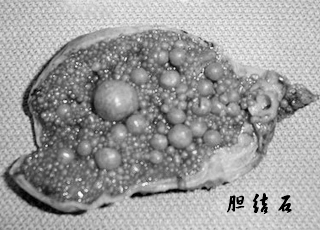 多发性药物流产危害,多发性药物流产