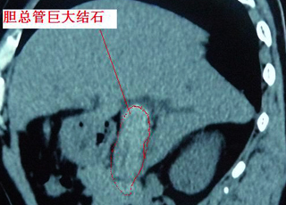 治疗人流检查,人流检查的危害