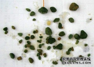 药物流产是怎么形成的,药物流产病因